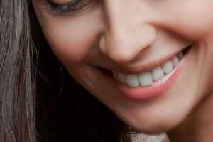 Chica con selladores dentales para proteger las molares