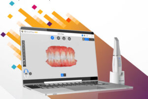 escaner intraoral Carestream dental