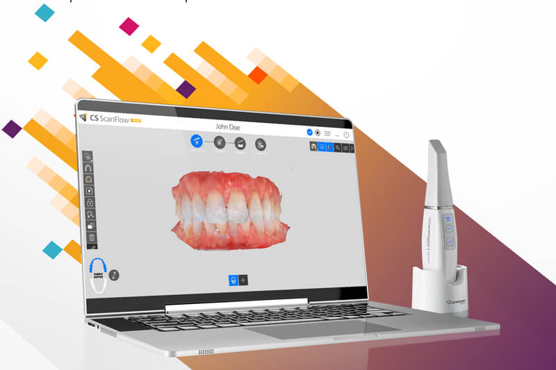escaner intraoral Carestream dental