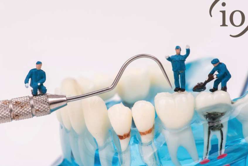 Mini dentistas haciendo una endodoncia
