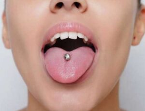 ¿Cómo afecta el piercing de la lengua a tu salud dental?