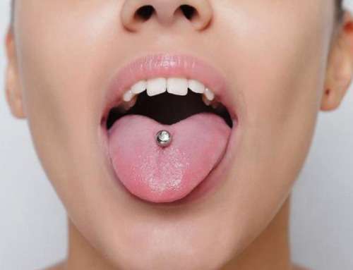¿Cómo afecta el piercing de la lengua a tu salud dental?