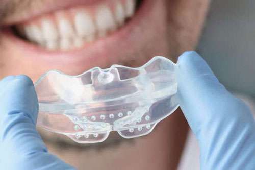 Tipos de férula dental