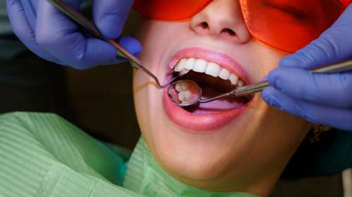 Diferencia entre higiene dental y curtaje