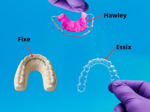 diferències retentor fix removible hawley y essix
